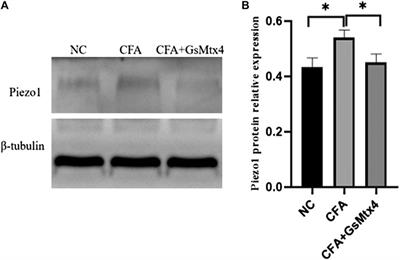 Piezo1 Affects Temporomandibular Joint Osteoarthritis by Influencing pSmad3